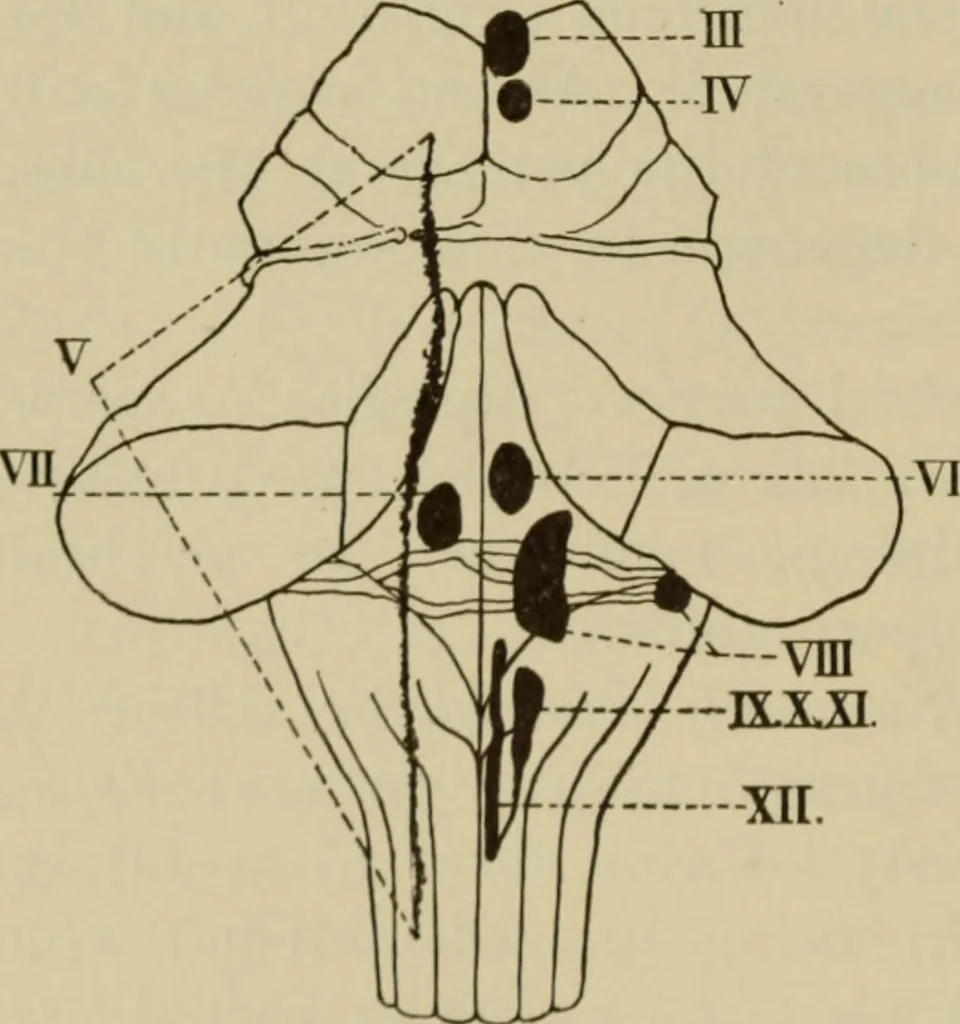An illustration from The diagnostics of internal medicine : a clinical treatise upon the recognised principles of medical diagnosis, prepared for the use of students and practitioners of medicine / by Glentworth Reeve Butler ... ; with five coloured plates and two hundred and seventy-two illustrations and charts in the text., 1909, leaf 598