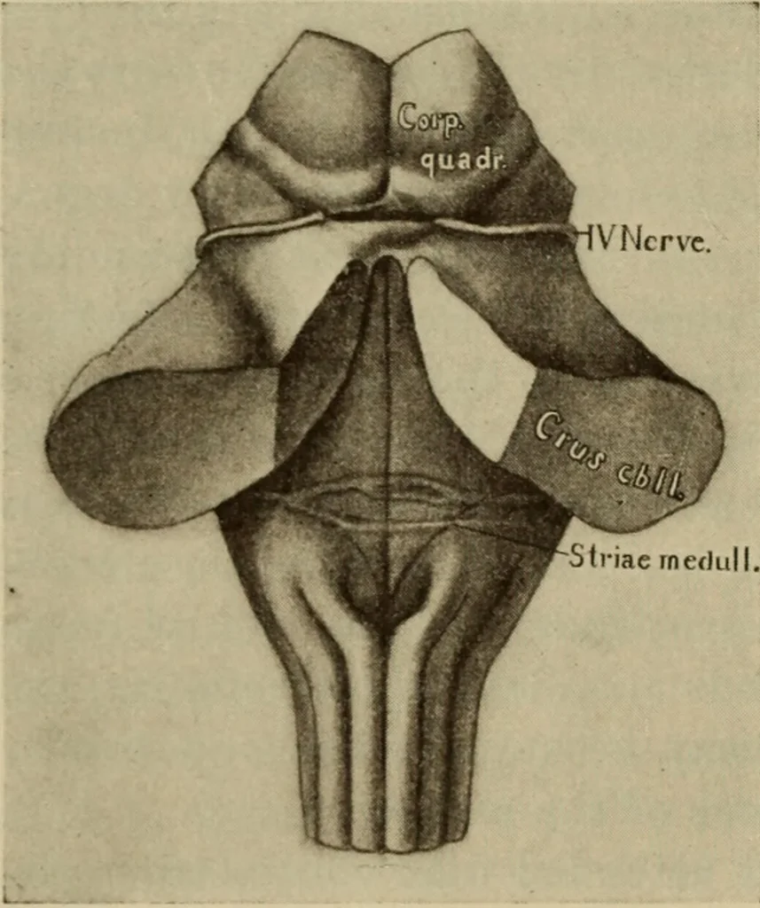 An illustration from The diagnostics of internal medicine : a clinical treatise upon the recognised principles of medical diagnosis, prepared for the use of students and practitioners of medicine / by Glentworth Reeve Butler ... ; with five coloured plates and two hundred and seventy-two illustrations and charts in the text., 1909, leaf 598