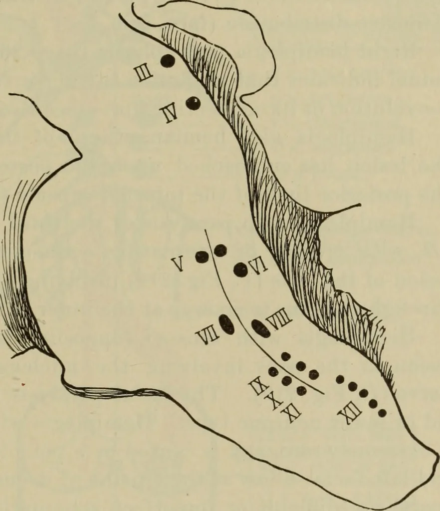 An illustration from The diagnostics of internal medicine : a clinical treatise upon the recognised principles of medical diagnosis, prepared for the use of students and practitioners of medicine / by Glentworth Reeve Butler ... ; with five coloured plates and two hundred and seventy-two illustrations and charts in the text., 1909, leaf 599