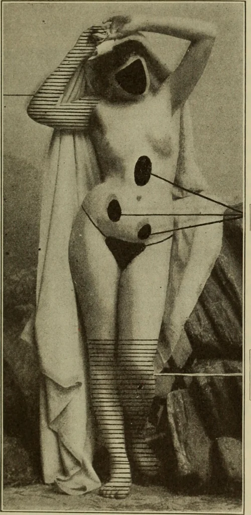 An illustration from The diagnostics of internal medicine : a clinical treatise upon the recognised principles of medical diagnosis, prepared for the use of students and practitioners of medicine / by Glentworth Reeve Butler ... ; with five coloured plates and two hundred and seventy-two illustrations and charts in the text., 1909, leaf 609