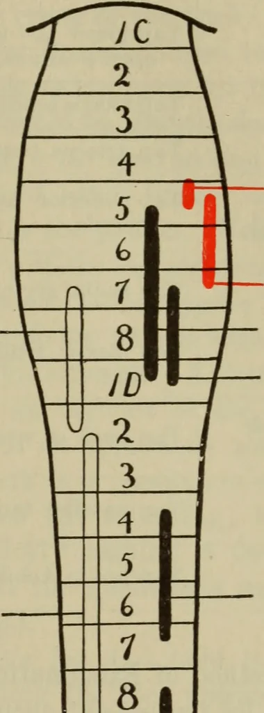 An illustration from The diagnostics of internal medicine : a clinical treatise upon the recognised principles of medical diagnosis, prepared for the use of students and practitioners of medicine / by Glentworth Reeve Butler ... ; with five coloured plates and two hundred and seventy-two illustrations and charts in the text., 1909, leaf 615