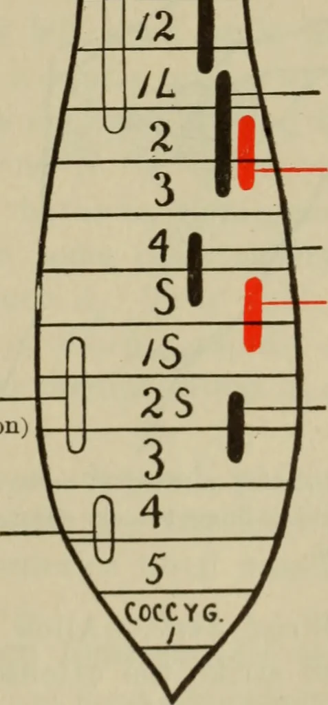 An illustration from The diagnostics of internal medicine : a clinical treatise upon the recognised principles of medical diagnosis, prepared for the use of students and practitioners of medicine / by Glentworth Reeve Butler ... ; with five coloured plates and two hundred and seventy-two illustrations and charts in the text., 1909, leaf 615