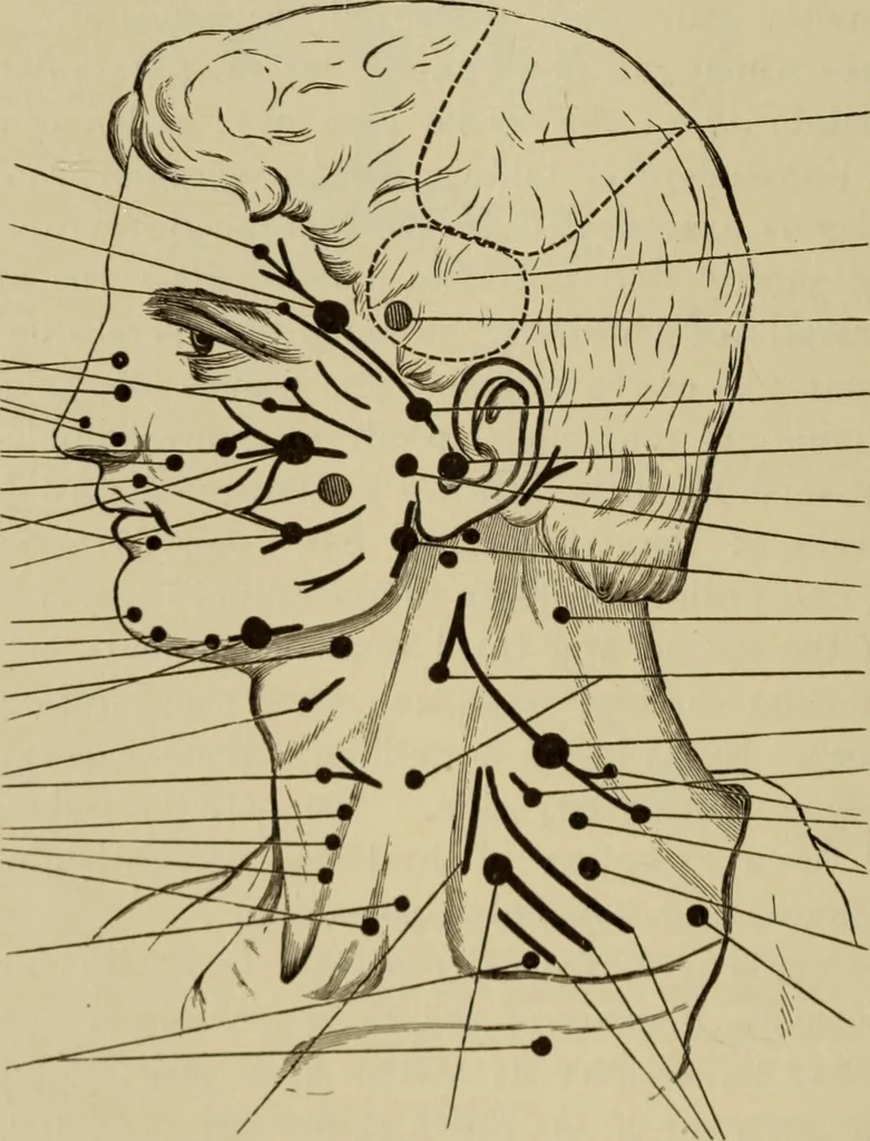 An illustration from The diagnostics of internal medicine : a clinical treatise upon the recognised principles of medical diagnosis, prepared for the use of students and practitioners of medicine / by Glentworth Reeve Butler ... ; with five coloured plates and two hundred and seventy-two illustrations and charts in the text., 1909, leaf 620