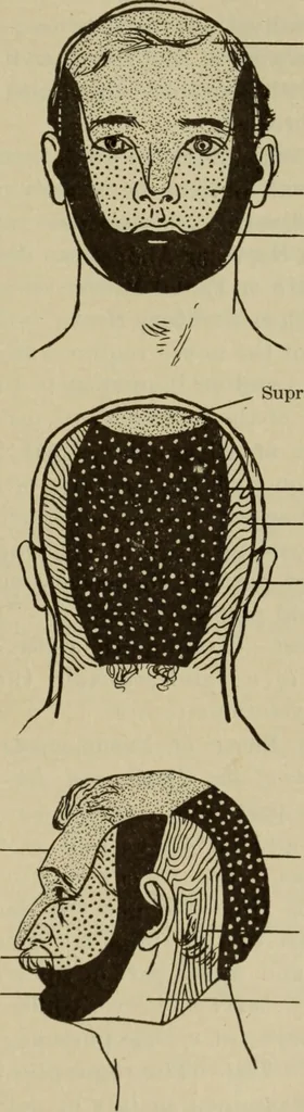 An illustration from The diagnostics of internal medicine : a clinical treatise upon the recognised principles of medical diagnosis, prepared for the use of students and practitioners of medicine / by Glentworth Reeve Butler ... ; with five coloured plates and two hundred and seventy-two illustrations and charts in the text., 1909, leaf 629