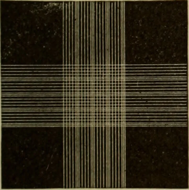 An illustration from The diagnostics of internal medicine : a clinical treatise upon the recognised principles of medical diagnosis, prepared for the use of students and practitioners of medicine / by Glentworth Reeve Butler ... ; with five coloured plates and two hundred and seventy-two illustrations and charts in the text., 1909, leaf 641