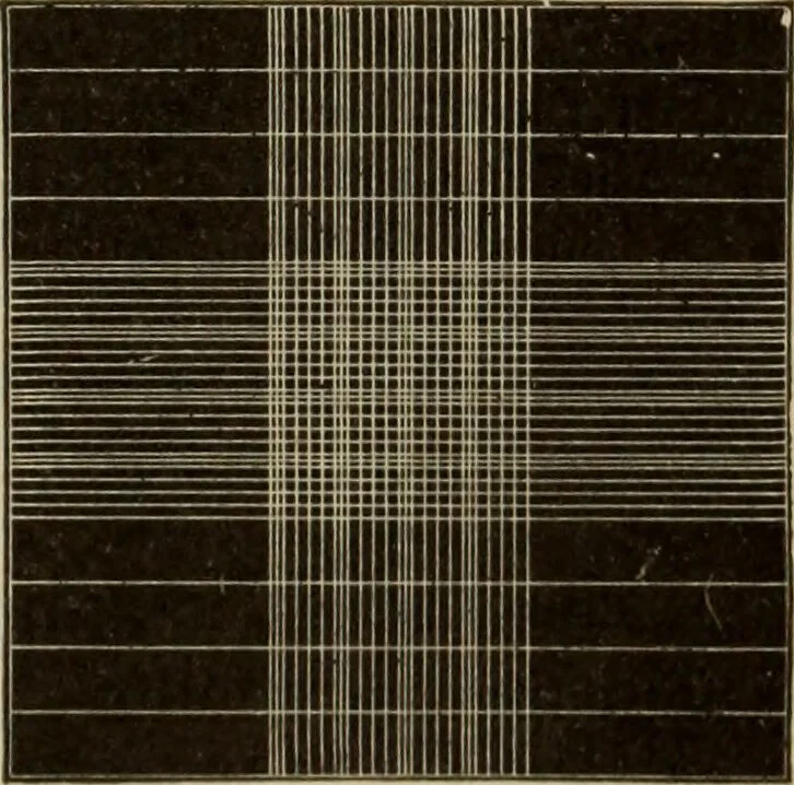 An illustration from The diagnostics of internal medicine : a clinical treatise upon the recognised principles of medical diagnosis, prepared for the use of students and practitioners of medicine / by Glentworth Reeve Butler ... ; with five coloured plates and two hundred and seventy-two illustrations and charts in the text., 1909, leaf 641