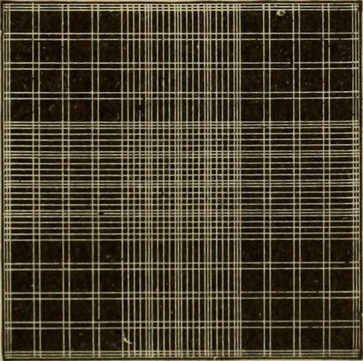 An illustration from The diagnostics of internal medicine : a clinical treatise upon the recognised principles of medical diagnosis, prepared for the use of students and practitioners of medicine / by Glentworth Reeve Butler ... ; with five coloured plates and two hundred and seventy-two illustrations and charts in the text., 1909, leaf 641