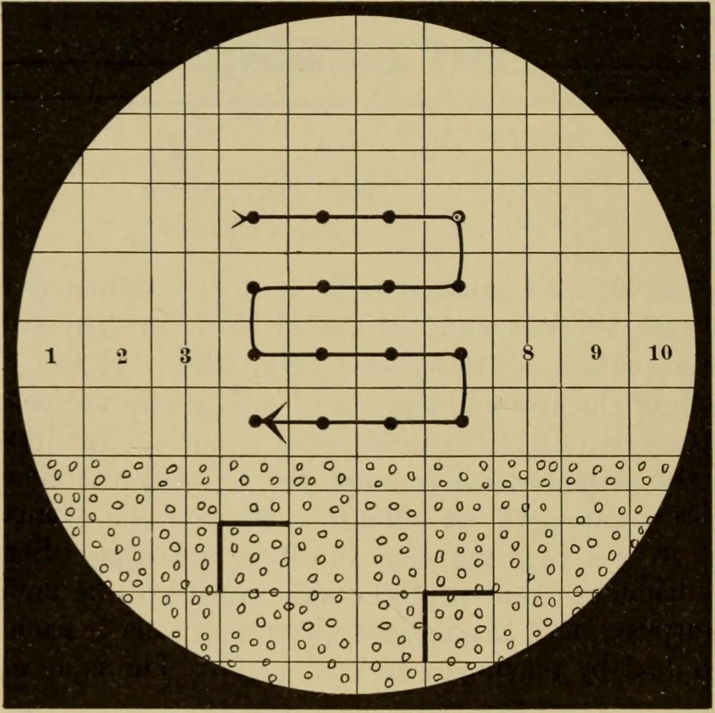 An illustration from The diagnostics of internal medicine : a clinical treatise upon the recognised principles of medical diagnosis, prepared for the use of students and practitioners of medicine / by Glentworth Reeve Butler ... ; with five coloured plates and two hundred and seventy-two illustrations and charts in the text., 1909, leaf 642