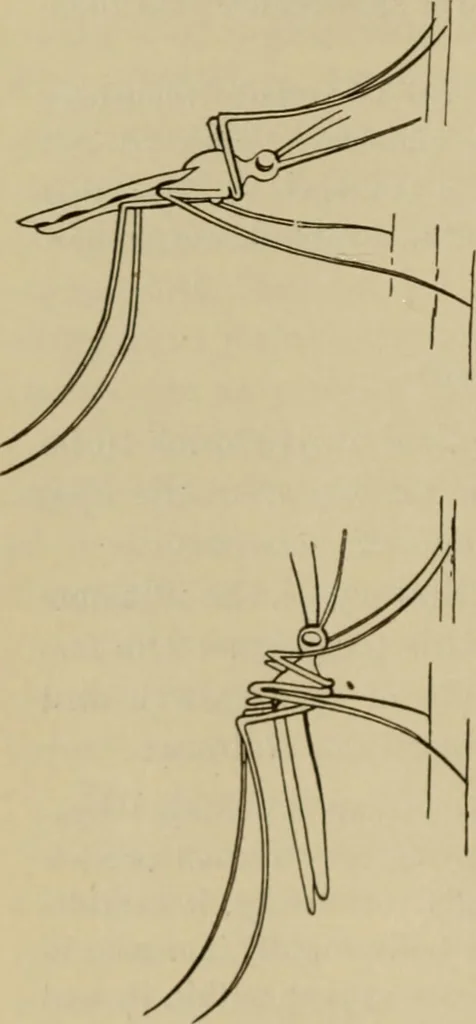 An illustration from The diagnostics of internal medicine : a clinical treatise upon the recognised principles of medical diagnosis, prepared for the use of students and practitioners of medicine / by Glentworth Reeve Butler ... ; with five coloured plates and two hundred and seventy-two illustrations and charts in the text., 1909, leaf 678
