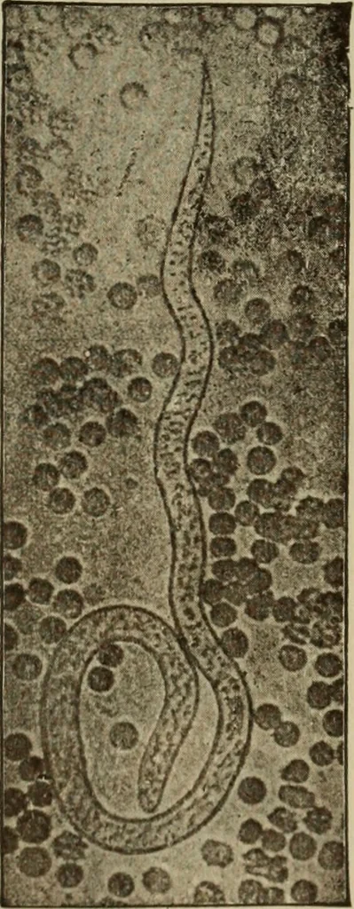 An illustration from The diagnostics of internal medicine : a clinical treatise upon the recognised principles of medical diagnosis, prepared for the use of students and practitioners of medicine / by Glentworth Reeve Butler ... ; with five coloured plates and two hundred and seventy-two illustrations and charts in the text., 1909, leaf 683