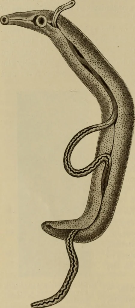 An illustration from The diagnostics of internal medicine : a clinical treatise upon the recognised principles of medical diagnosis, prepared for the use of students and practitioners of medicine / by Glentworth Reeve Butler ... ; with five coloured plates and two hundred and seventy-two illustrations and charts in the text., 1909, leaf 684