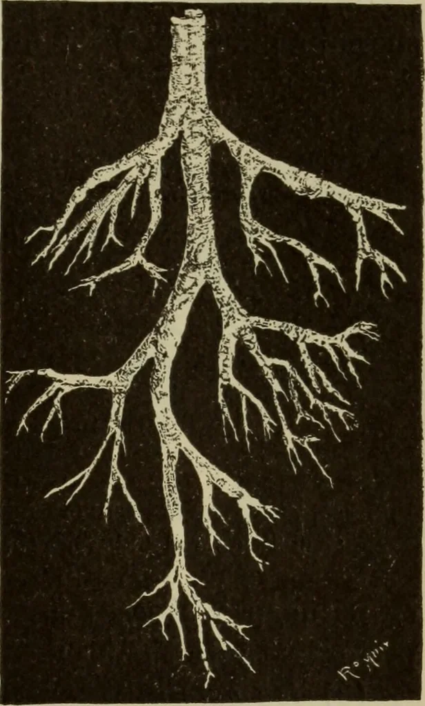 An illustration from The diagnostics of internal medicine : a clinical treatise upon the recognised principles of medical diagnosis, prepared for the use of students and practitioners of medicine / by Glentworth Reeve Butler ... ; with five coloured plates and two hundred and seventy-two illustrations and charts in the text., 1909, leaf 701