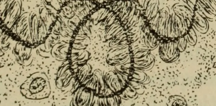 An illustration from The diagnostics of internal medicine : a clinical treatise upon the recognised principles of medical diagnosis, prepared for the use of students and practitioners of medicine / by Glentworth Reeve Butler ... ; with five coloured plates and two hundred and seventy-two illustrations and charts in the text., 1909, leaf 701