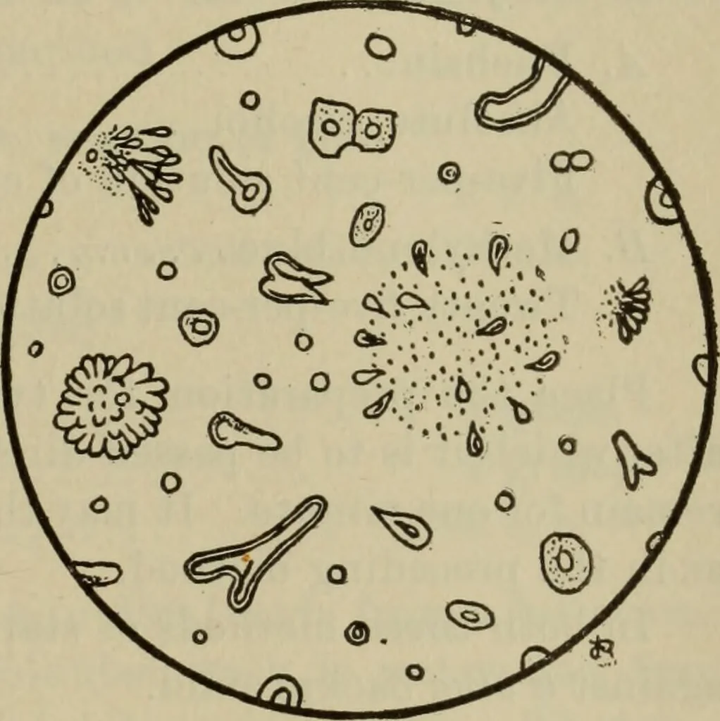An illustration from The diagnostics of internal medicine : a clinical treatise upon the recognised principles of medical diagnosis, prepared for the use of students and practitioners of medicine / by Glentworth Reeve Butler ... ; with five coloured plates and two hundred and seventy-two illustrations and charts in the text., 1909, leaf 703
