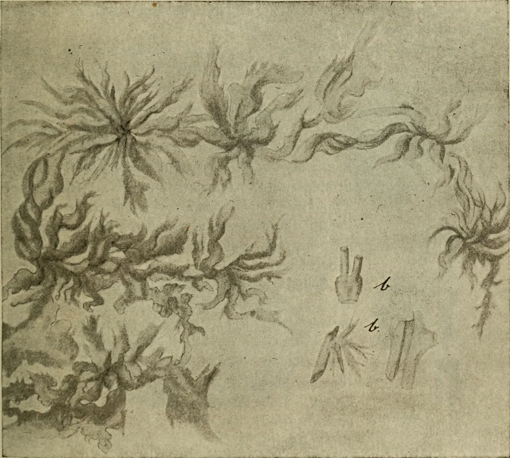 An illustration from The diagnostics of internal medicine : a clinical treatise upon the recognised principles of medical diagnosis, prepared for the use of students and practitioners of medicine / by Glentworth Reeve Butler ... ; with five coloured plates and two hundred and seventy-two illustrations and charts in the text., 1909, leaf 725