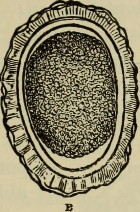 An illustration from The diagnostics of internal medicine : a clinical treatise upon the recognised principles of medical diagnosis, prepared for the use of students and practitioners of medicine / by Glentworth Reeve Butler ... ; with five coloured plates and two hundred and seventy-two illustrations and charts in the text., 1909, leaf 727