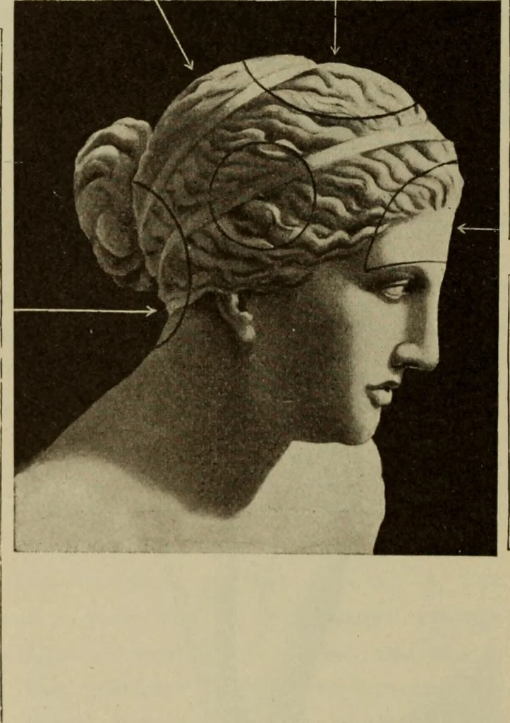 An illustration from The diagnostics of internal medicine : a clinical treatise upon the recognised principles of medical diagnosis, prepared for the use of students and practitioners of medicine / by Glentworth Reeve Butler ... ; with five coloured plates and two hundred and seventy-two illustrations and charts in the text., 1909, leaf 88