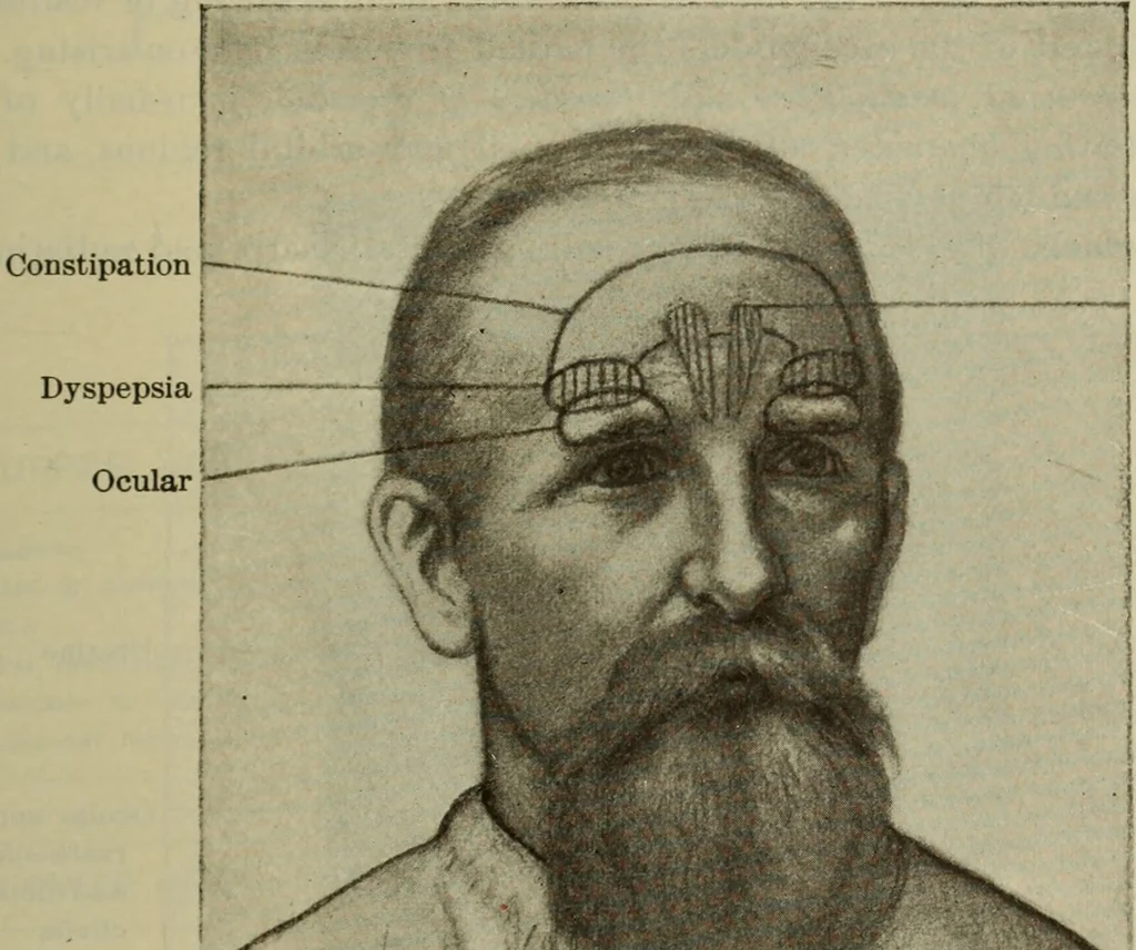 An illustration from The diagnostics of internal medicine : a clinical treatise upon the recognised principles of medical diagnosis, prepared for the use of students and practitioners of medicine / by Glentworth Reeve Butler ... ; with five coloured plates and two hundred and seventy-two illustrations and charts in the text., 1909, leaf 89