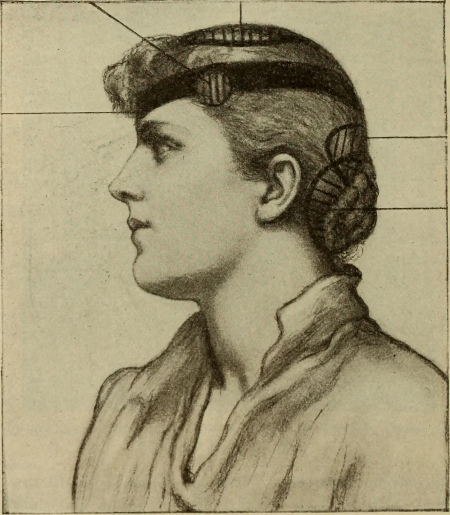 An illustration from The diagnostics of internal medicine : a clinical treatise upon the recognised principles of medical diagnosis, prepared for the use of students and practitioners of medicine / by Glentworth Reeve Butler ... ; with five coloured plates and two hundred and seventy-two illustrations and charts in the text., 1909, leaf 90