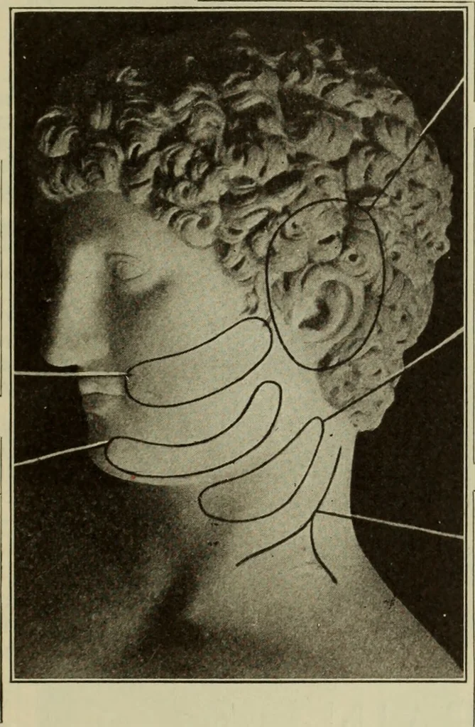 An illustration from The diagnostics of internal medicine : a clinical treatise upon the recognised principles of medical diagnosis, prepared for the use of students and practitioners of medicine / by Glentworth Reeve Butler ... ; with five coloured plates and two hundred and seventy-two illustrations and charts in the text., 1909, leaf 91