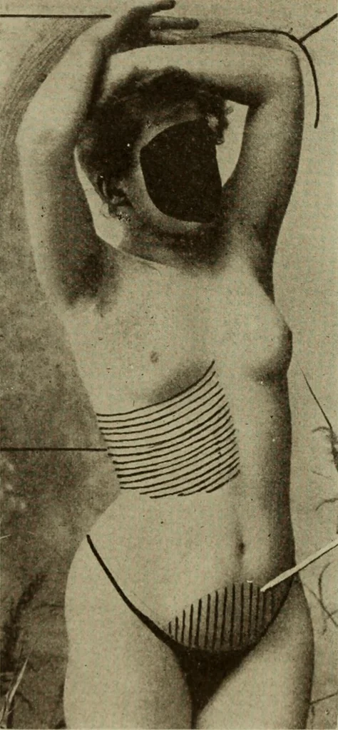 An illustration from The diagnostics of internal medicine : a clinical treatise upon the recognised principles of medical diagnosis, prepared for the use of students and practitioners of medicine / by Glentworth Reeve Butler ... ; with five coloured plates and two hundred and seventy-two illustrations and charts in the text., 1909, leaf 94
