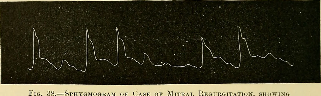 An illustration from Diseases of the heart and arterial system : designed to be a practical presentation of the subject for the use of students and practitioners of medicine / by Robert H. Babcock ; with three coloured plates and one hundred and thirty-nine illustrations., 1907, leaf 270