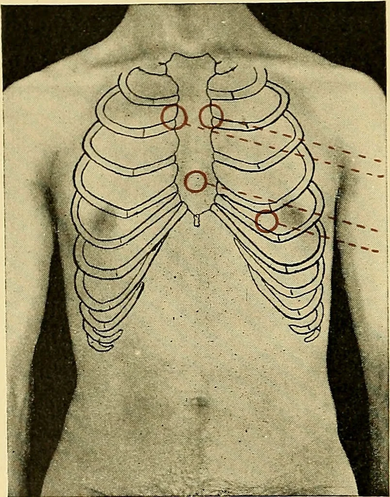An illustration from Diseases of the heart and arterial system : designed to be a practical presentation of the subject for the use of students and practitioners of medicine / by Robert H. Babcock ; with three coloured plates and one hundred and thirty-nine illustrations., 1907, leaf 34