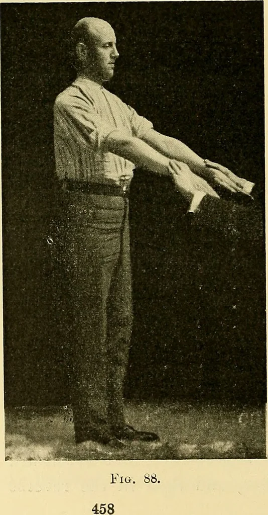 An illustration from Diseases of the heart and arterial system : designed to be a practical presentation of the subject for the use of students and practitioners of medicine / by Robert H. Babcock ; with three coloured plates and one hundred and thirty-nine illustrations., 1907, leaf 490