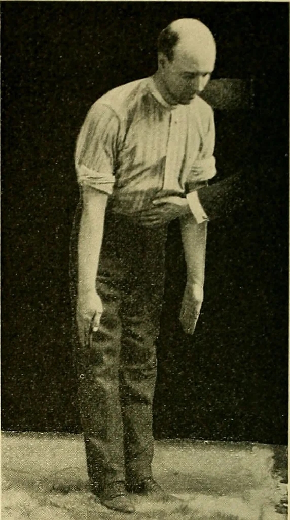 An illustration from Diseases of the heart and arterial system : designed to be a practical presentation of the subject for the use of students and practitioners of medicine / by Robert H. Babcock ; with three coloured plates and one hundred and thirty-nine illustrations., 1907, leaf 492