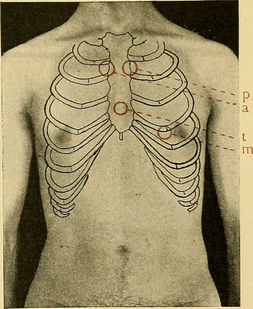 An illustration from Diseases of the heart and arterial system : designed to be a practical presentation of the subject for the use of students and practitioners of medicine / by Robert H. Babcock ; with three coloured plates and one hundred and thirty-nine illustrations., 1907, leaf 55