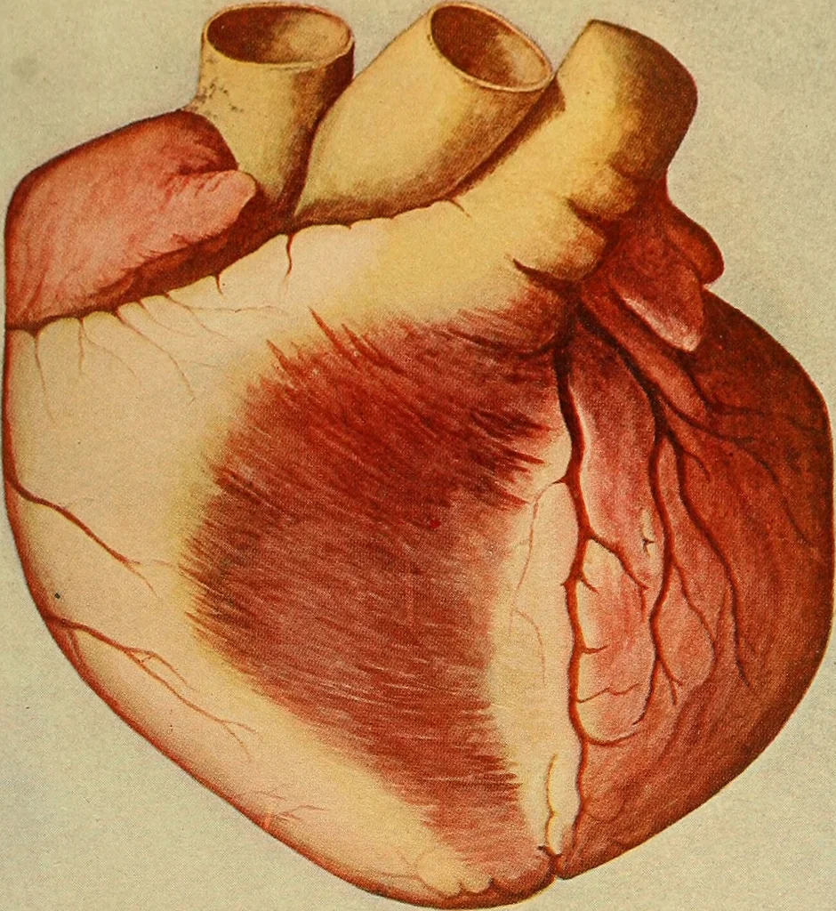 An illustration from Diseases of the heart and arterial system : designed to be a practical presentation of the subject for the use of students and practitioners of medicine / by Robert H. Babcock ; with three coloured plates and one hundred and thirty-nine illustrations., 1907, leaf 609