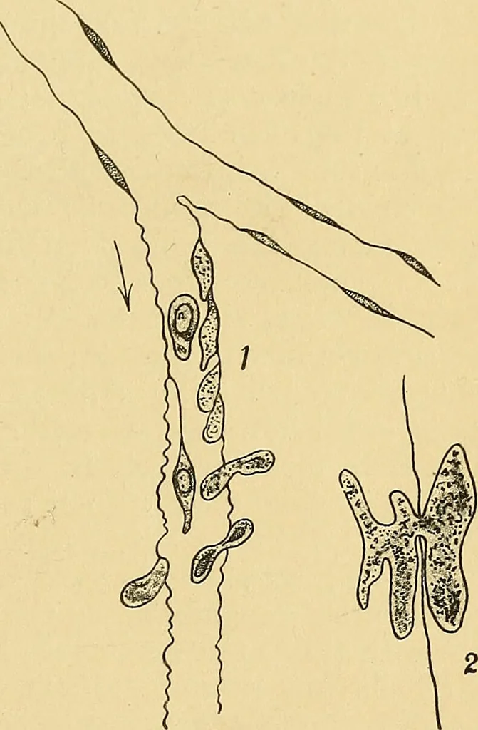 An illustration from A text-book of pathology for students of medicine / by J. George Adami and John McCrae ; illustrated with 304 engravings and 11 colored plates., 1912, leaf 131