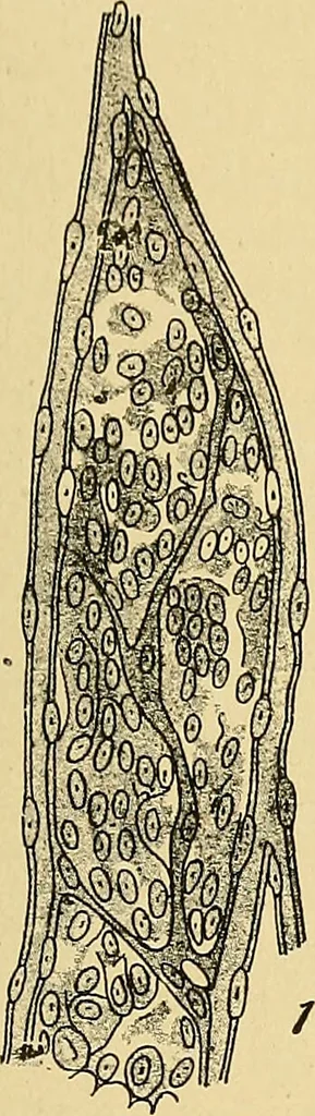 An illustration from A text-book of pathology for students of medicine / by J. George Adami and John McCrae ; illustrated with 304 engravings and 11 colored plates., 1912, leaf 149