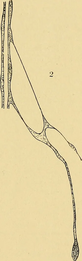 An illustration from A text-book of pathology for students of medicine / by J. George Adami and John McCrae ; illustrated with 304 engravings and 11 colored plates., 1912, leaf 149