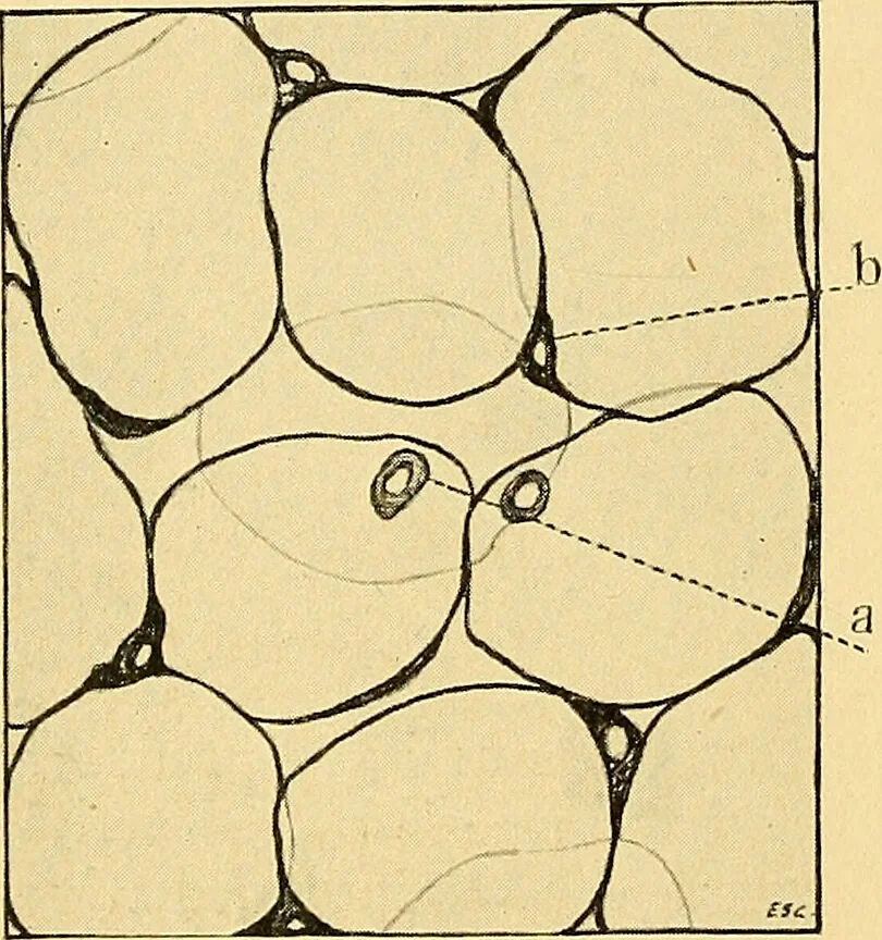 An illustration from A text-book of pathology for students of medicine / by J. George Adami and John McCrae ; illustrated with 304 engravings and 11 colored plates., 1912, leaf 18