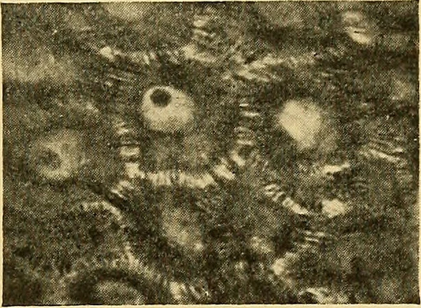 An illustration from A text-book of pathology for students of medicine / by J. George Adami and John McCrae ; illustrated with 304 engravings and 11 colored plates., 1912, leaf 19