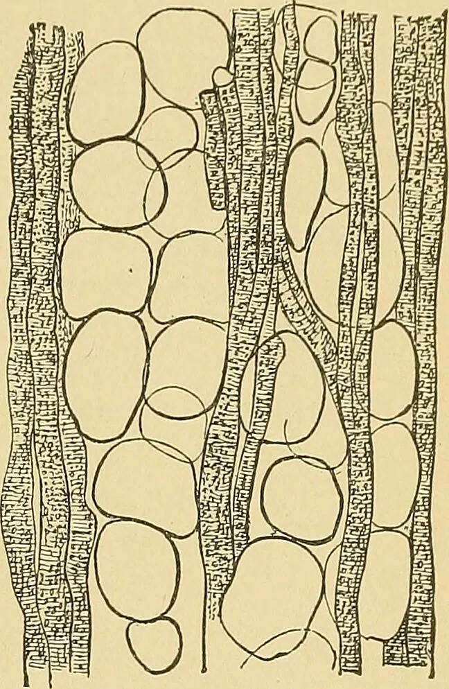 An illustration from A text-book of pathology for students of medicine / by J. George Adami and John McCrae ; illustrated with 304 engravings and 11 colored plates., 1912, leaf 199