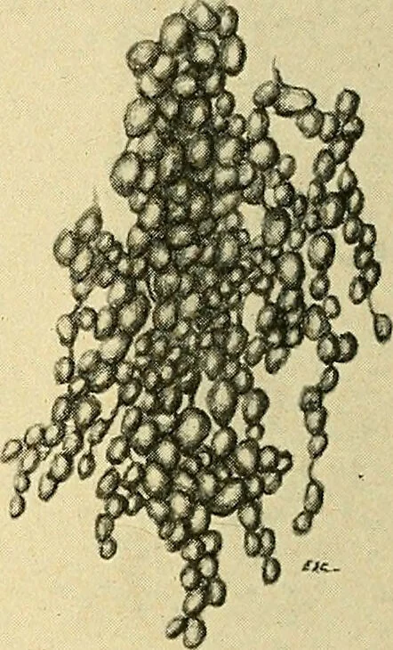 An illustration from A text-book of pathology for students of medicine / by J. George Adami and John McCrae ; illustrated with 304 engravings and 11 colored plates., 1912, leaf 230