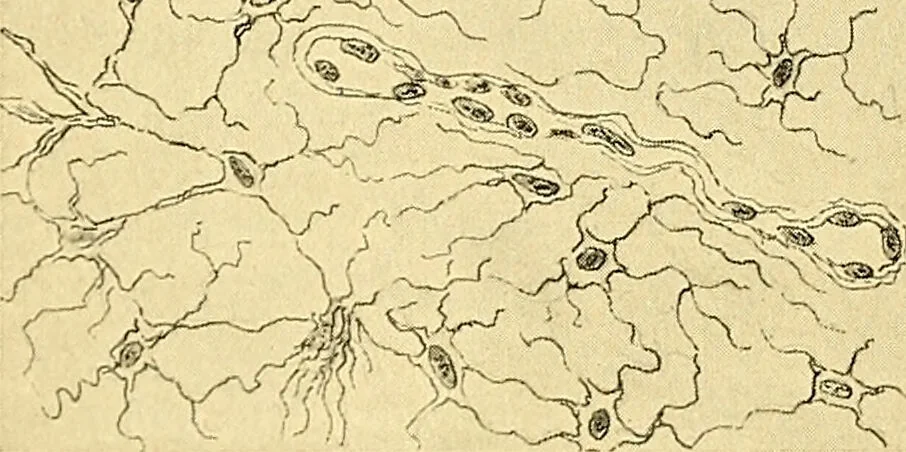 An illustration from A text-book of pathology for students of medicine / by J. George Adami and John McCrae ; illustrated with 304 engravings and 11 colored plates., 1912, leaf 244