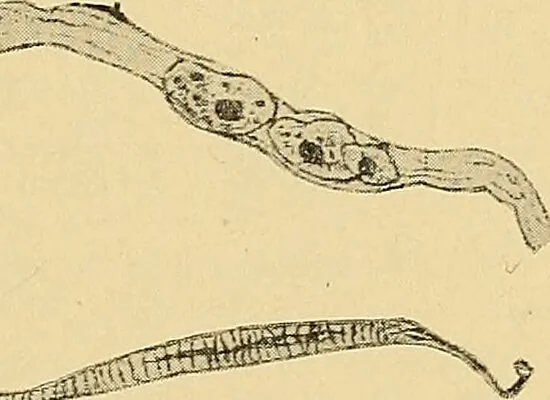 An illustration from A text-book of pathology for students of medicine / by J. George Adami and John McCrae ; illustrated with 304 engravings and 11 colored plates., 1912, leaf 255