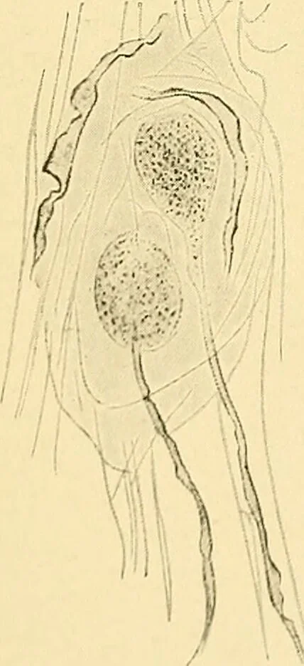 An illustration from A text-book of pathology for students of medicine / by J. George Adami and John McCrae ; illustrated with 304 engravings and 11 colored plates., 1912, leaf 256