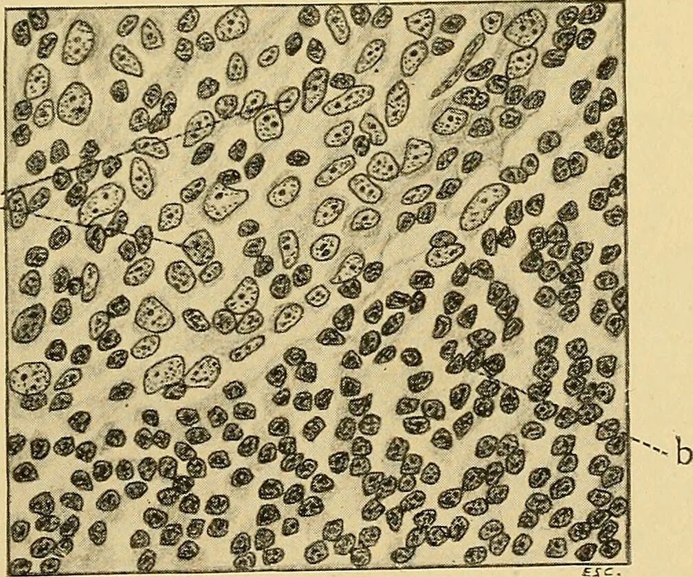 An illustration from A text-book of pathology for students of medicine / by J. George Adami and John McCrae ; illustrated with 304 engravings and 11 colored plates., 1912, leaf 263