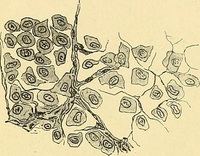 An illustration from A text-book of pathology for students of medicine / by J. George Adami and John McCrae ; illustrated with 304 engravings and 11 colored plates., 1912, leaf 266