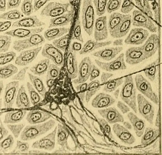 An illustration from A text-book of pathology for students of medicine / by J. George Adami and John McCrae ; illustrated with 304 engravings and 11 colored plates., 1912, leaf 266