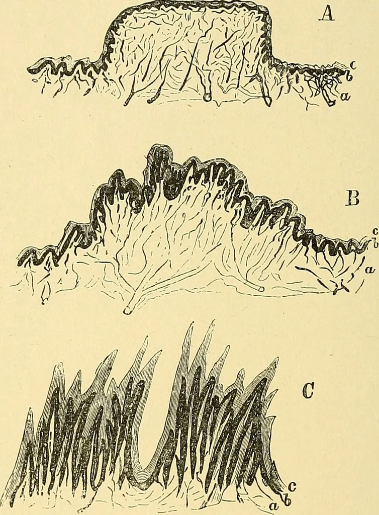 An illustration from A text-book of pathology for students of medicine / by J. George Adami and John McCrae ; illustrated with 304 engravings and 11 colored plates., 1912, leaf 270