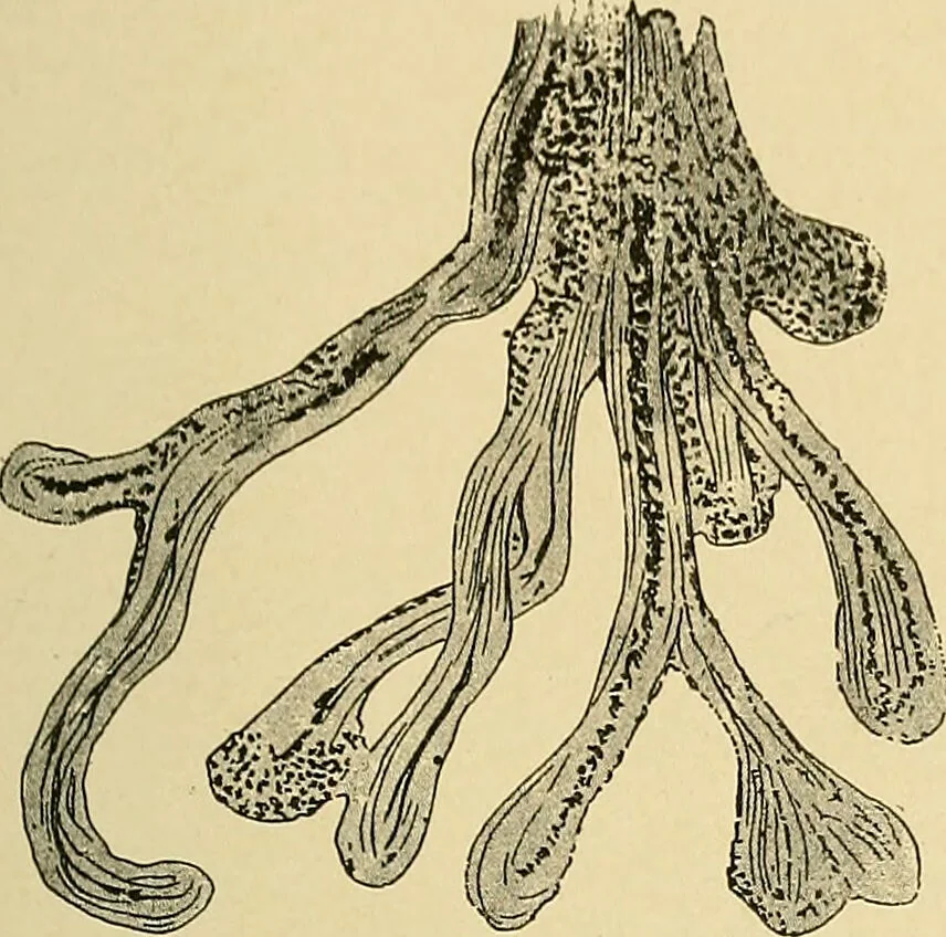 An illustration from A text-book of pathology for students of medicine / by J. George Adami and John McCrae ; illustrated with 304 engravings and 11 colored plates., 1912, leaf 273