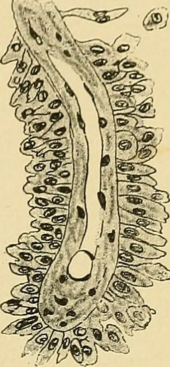 An illustration from A text-book of pathology for students of medicine / by J. George Adami and John McCrae ; illustrated with 304 engravings and 11 colored plates., 1912, leaf 273