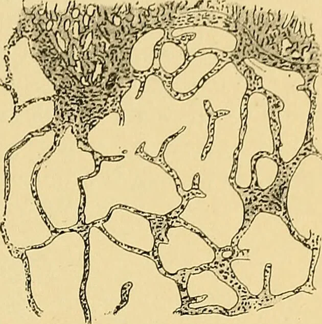 An illustration from A text-book of pathology for students of medicine / by J. George Adami and John McCrae ; illustrated with 304 engravings and 11 colored plates., 1912, leaf 293