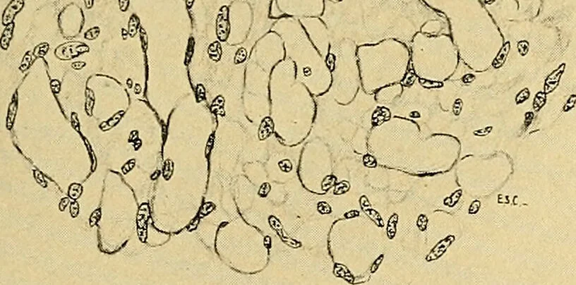 An illustration from A text-book of pathology for students of medicine / by J. George Adami and John McCrae ; illustrated with 304 engravings and 11 colored plates., 1912, leaf 295