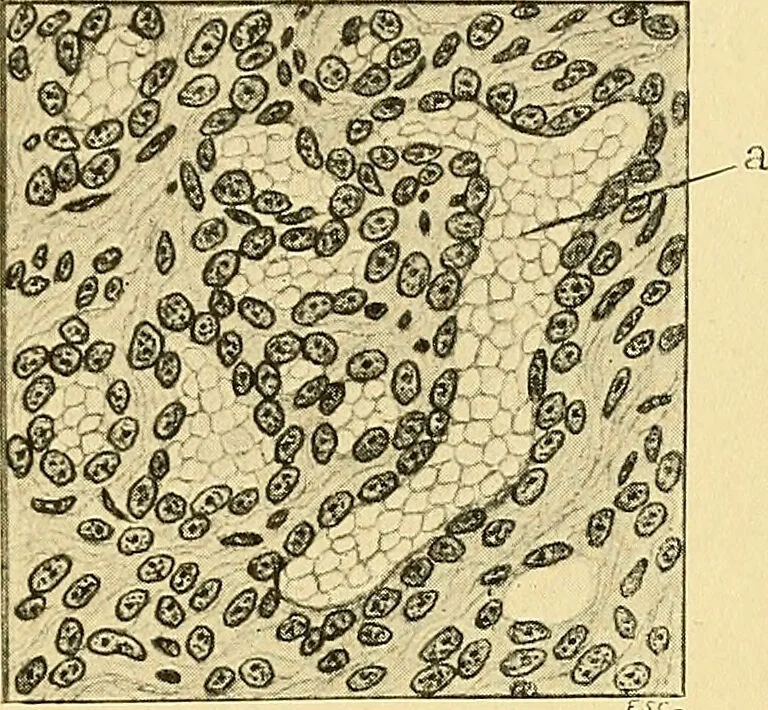 An illustration from A text-book of pathology for students of medicine / by J. George Adami and John McCrae ; illustrated with 304 engravings and 11 colored plates., 1912, leaf 296